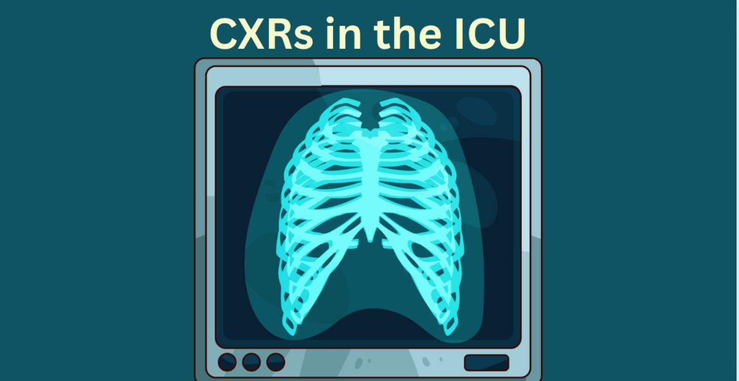 Basic CXR reading