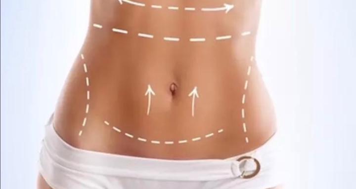 Post Plastic Surgery