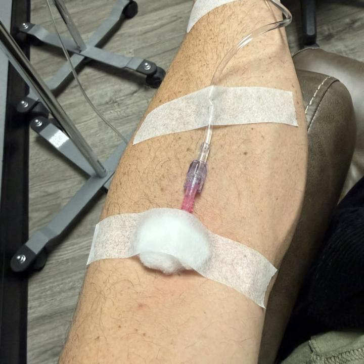 I had a headache the other day.