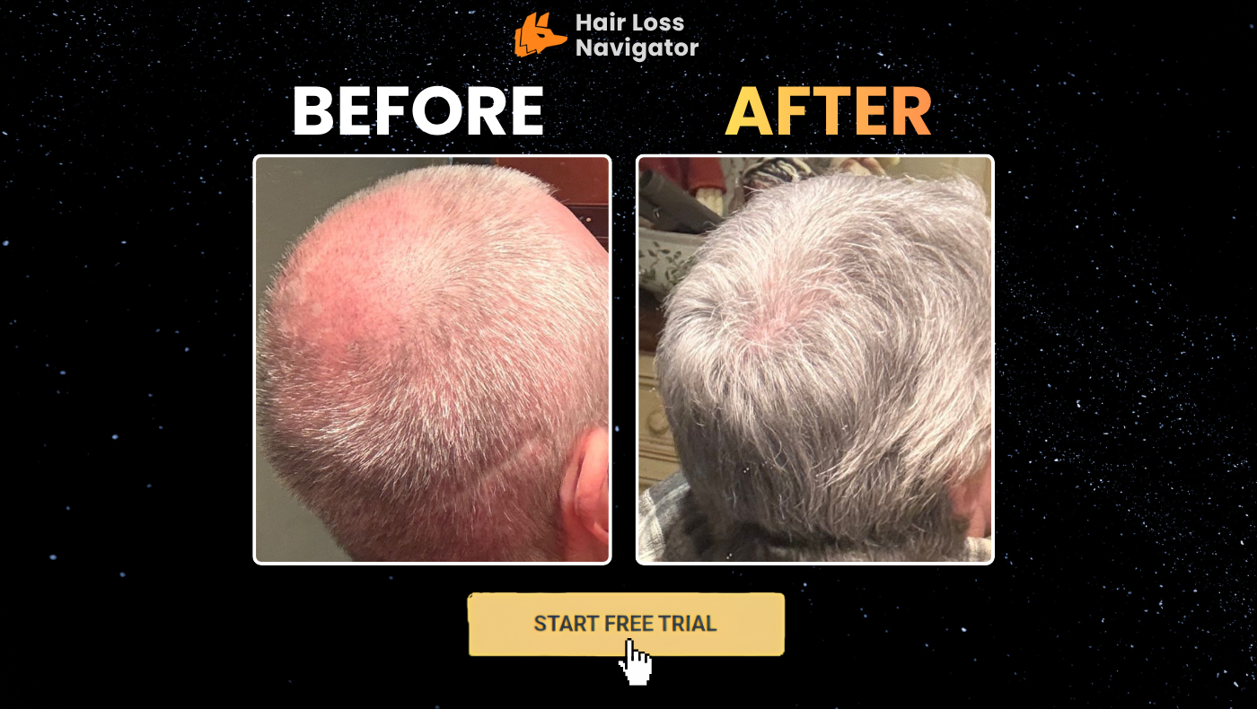Hair Loss Navigator
