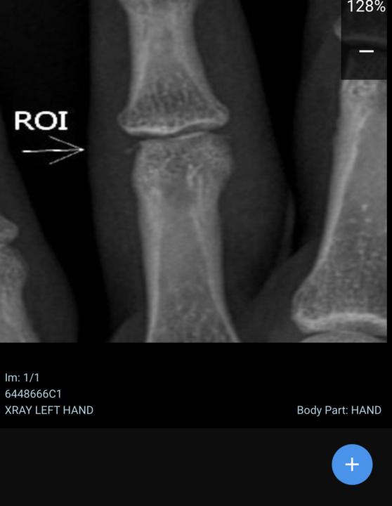 Injury update