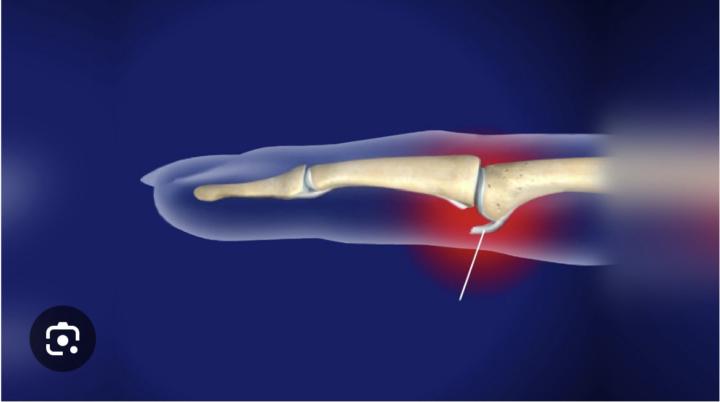 Injury update