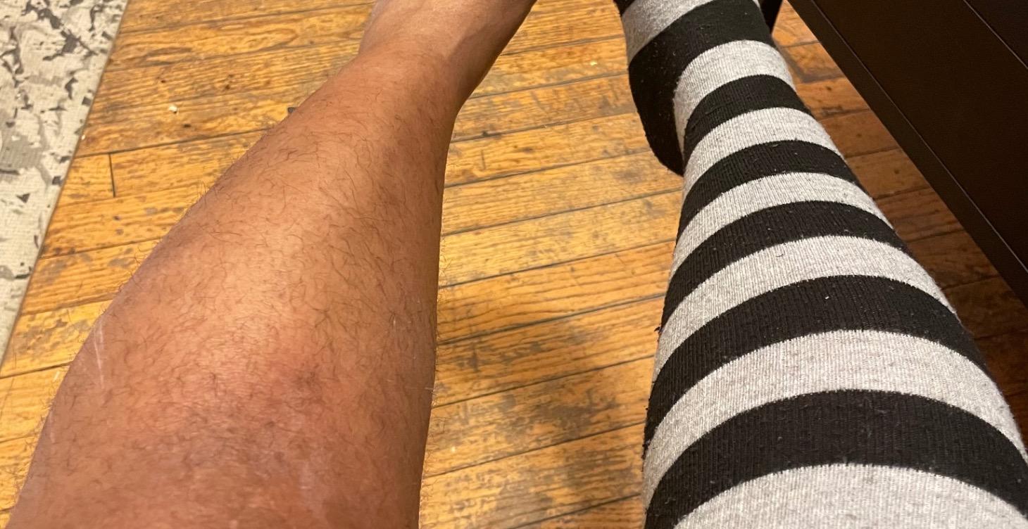 Understanding dementia