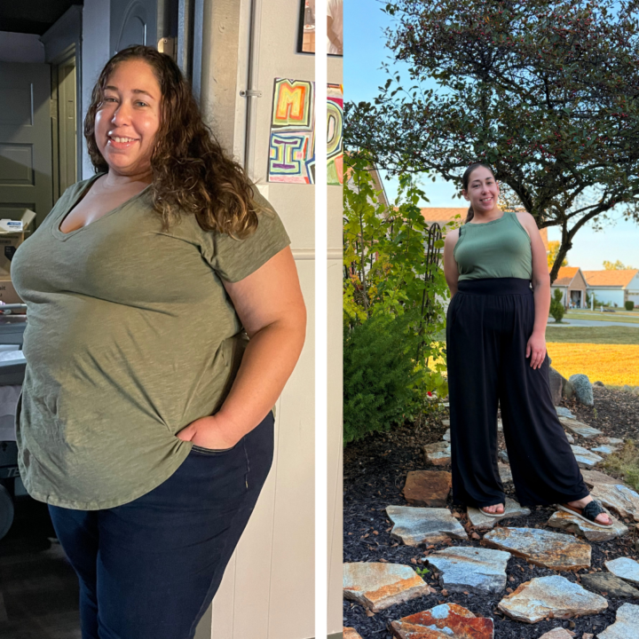 Maintaining after no injections / Hair loss?