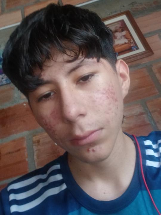 Jhosep Prato