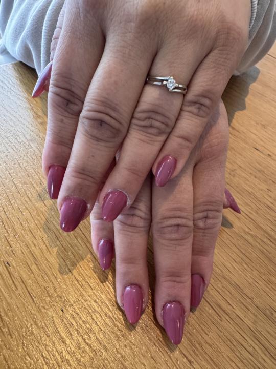 Ricostruzione in Acrigel