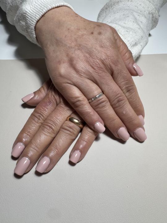 Ricostruzione con Gel