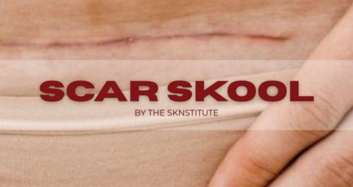 SCAR SKOOL