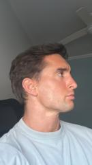 Alvaro Hernández