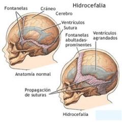 Dhenis Rojas Condori