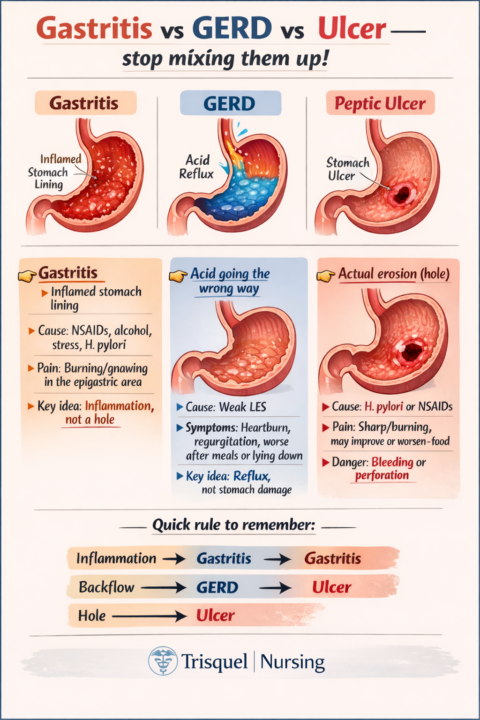 Gastritis vs GERD vs Ulcer — stop mixing them up