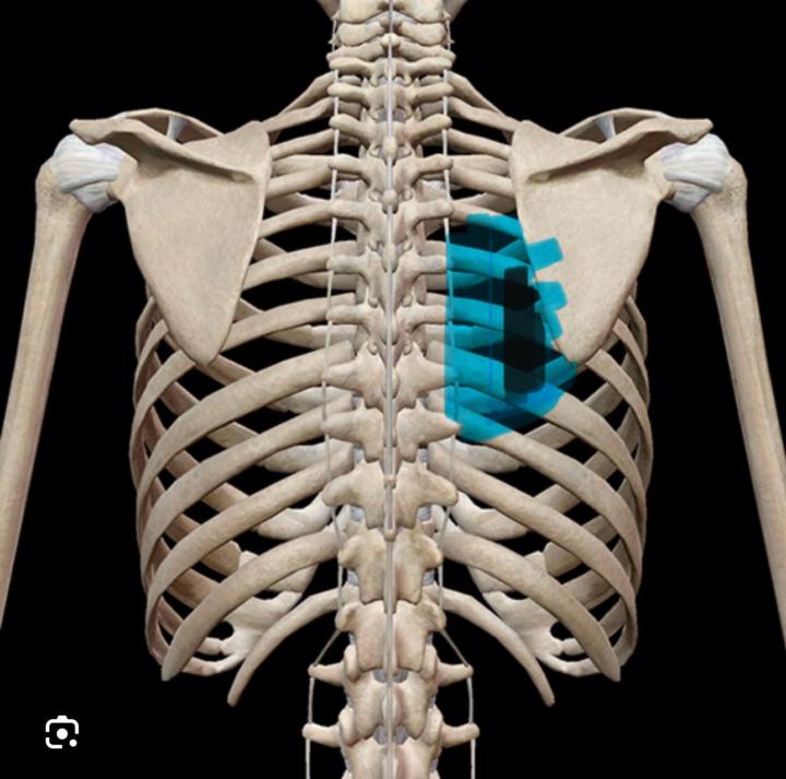 Rhomboid/trap tightness. 