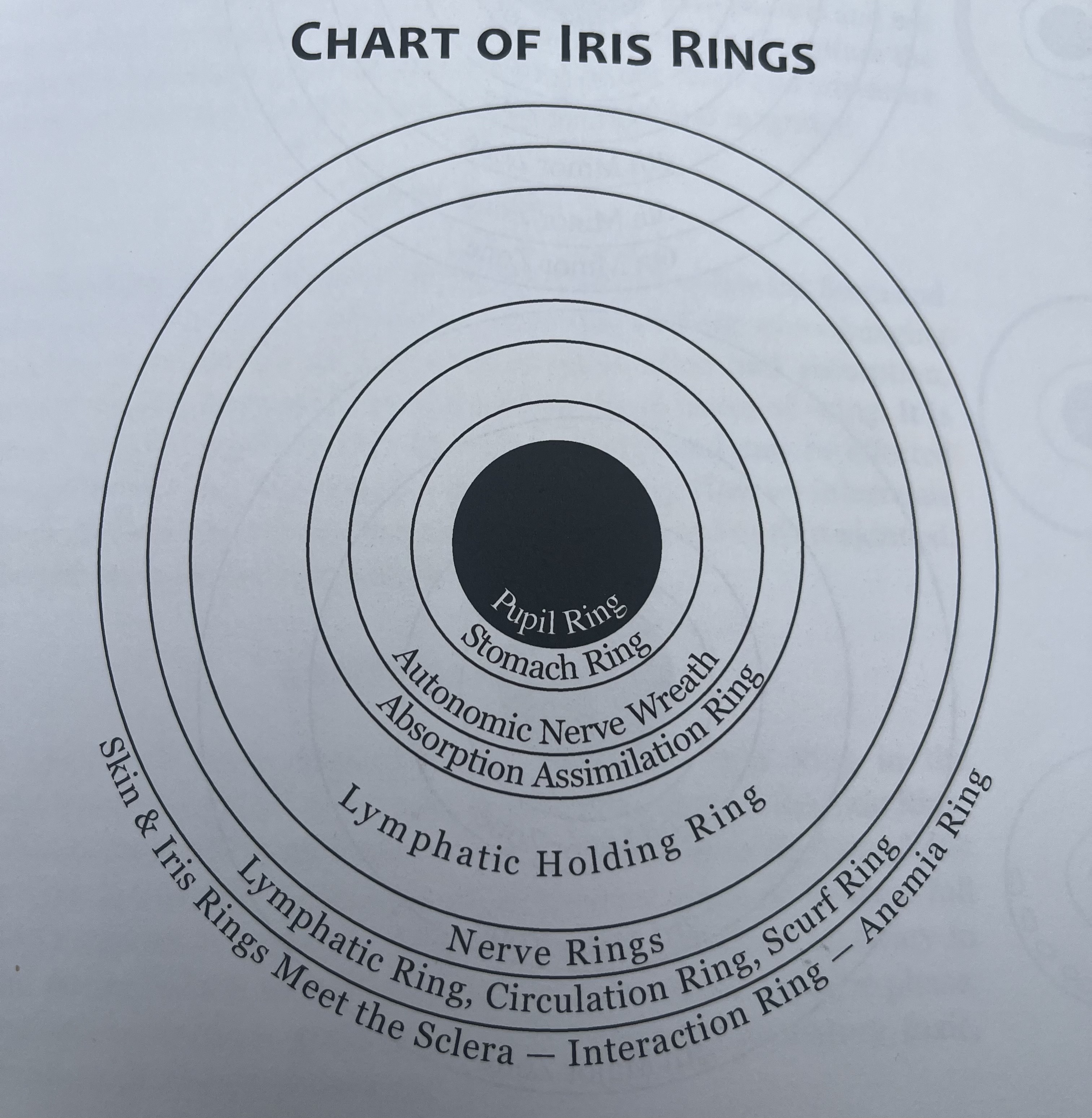 Iris Ring Zones · Understand Thyself