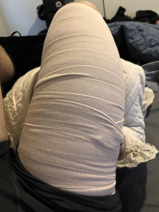 Quad Strain Rehab - first 24hrs