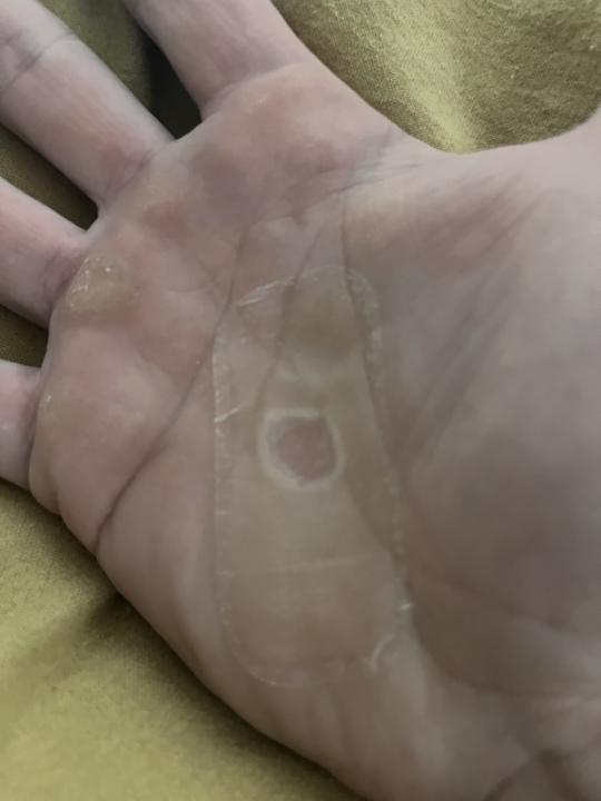 The BEST Rip Repair 