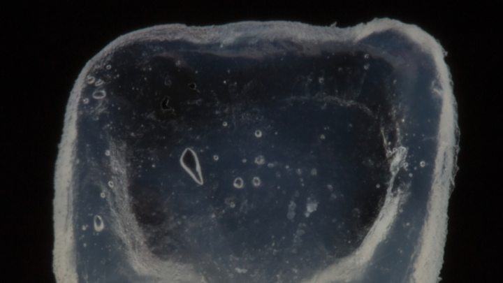 Diente estratificado de resina (Essentia de GC)