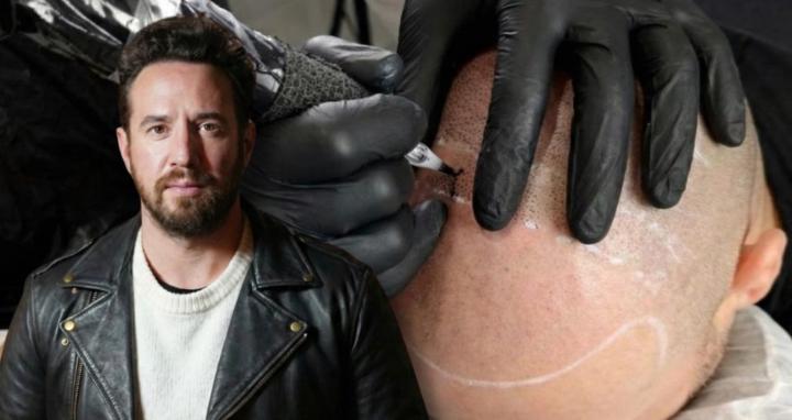 MicroBarber™ SMP Mastery