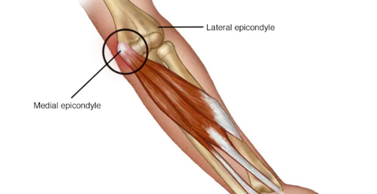 Elbow Pain Manual