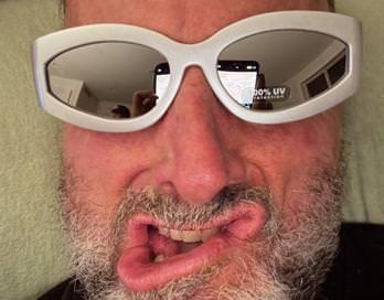 Fredric Biltz