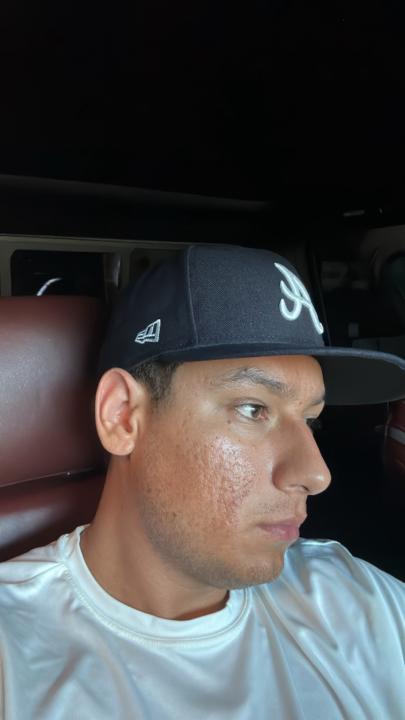 Josh Arteaga