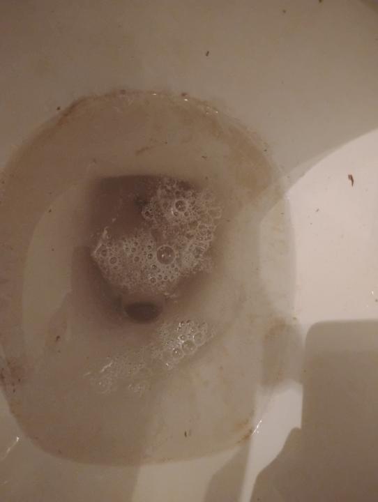 Numerous different types of parasites are in our urine! Look at the white bubbles that came from my urine. 