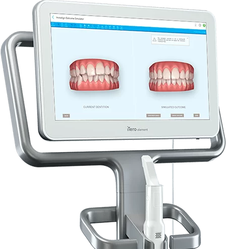 Dientes Inamovibles | Dra. Marta Cuadra — Anclaje en el ClinCheck