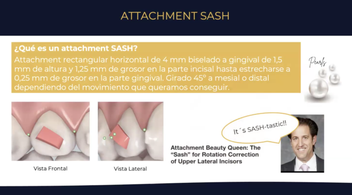 Ataches Invisalign | Dra. Marta Cuadra — El Secreto del Atache SASH