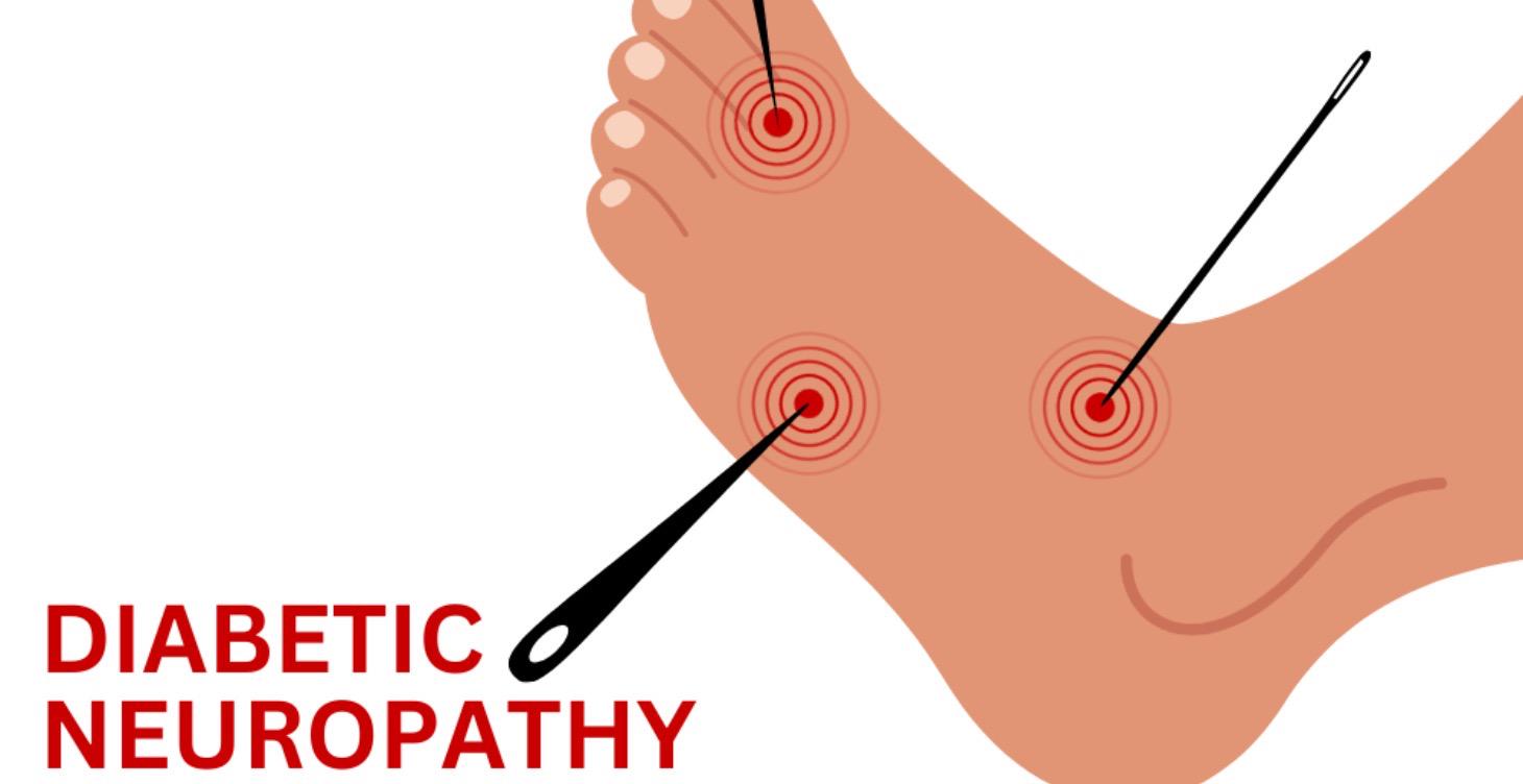 Diabetic neuropathy and diabetic foot care tips!