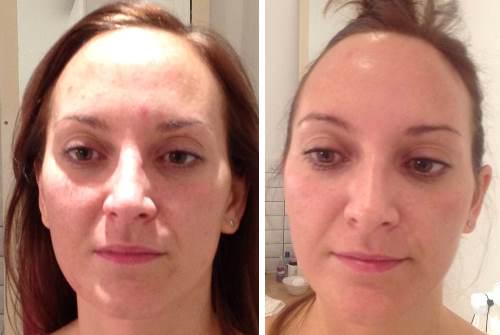 A Light Facial For YOUR Skin 