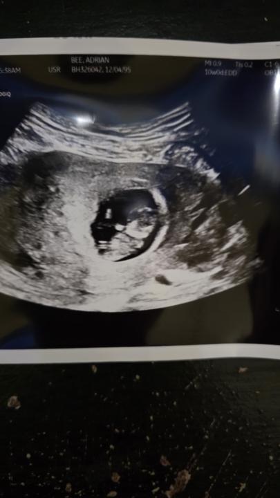 So our little surprise 