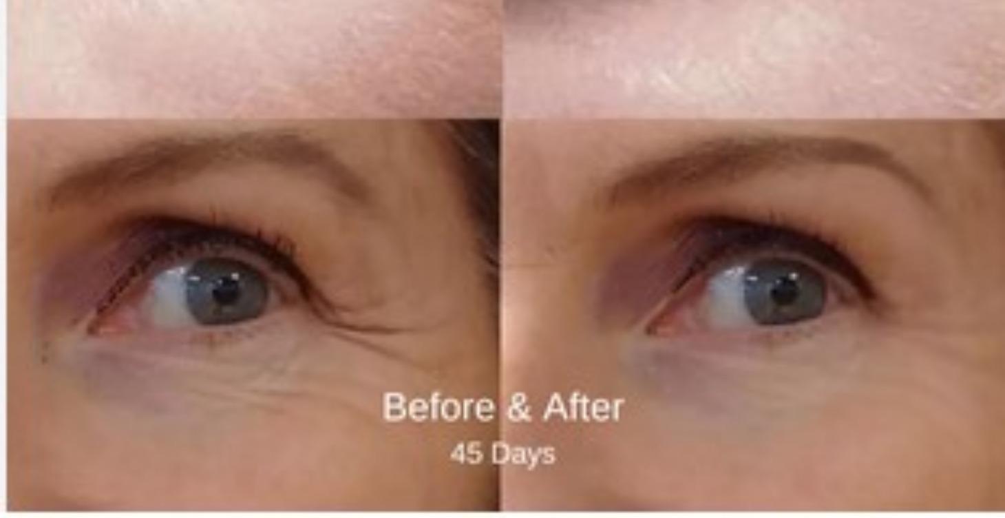 ARGIRELINE HEXAPEPTIDE (TOPICAL)