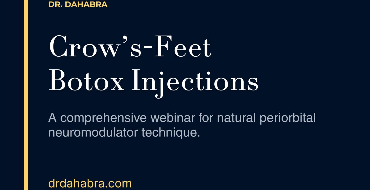 Crow's Feet Botox Injections