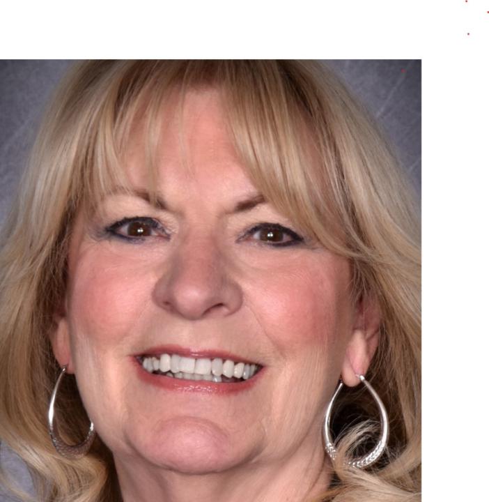 Linda Bobski