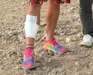 What happened to Goose's leg?