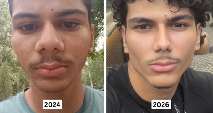 Salvatore Pill