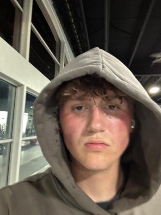 Tyson Archibald
