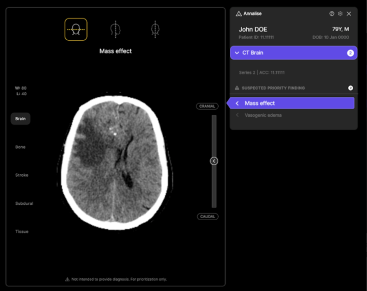 Australian HealthTech Startup Harrison.ai Secures $112M in Series C Funding