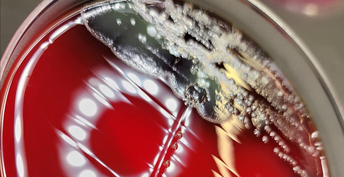 Microbiology Flow Charts