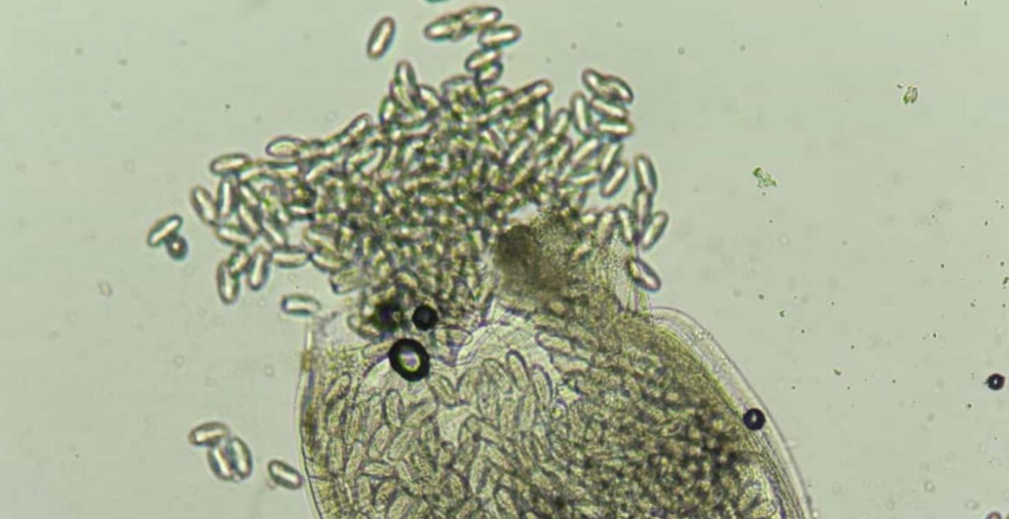 Ultimate Parasitology Guide