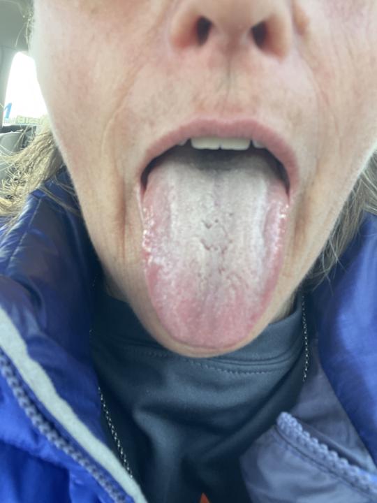 Tongue curiosity