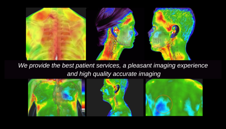 What Is Thermography — And Why Every Woman Over 40 Needs to Know About It