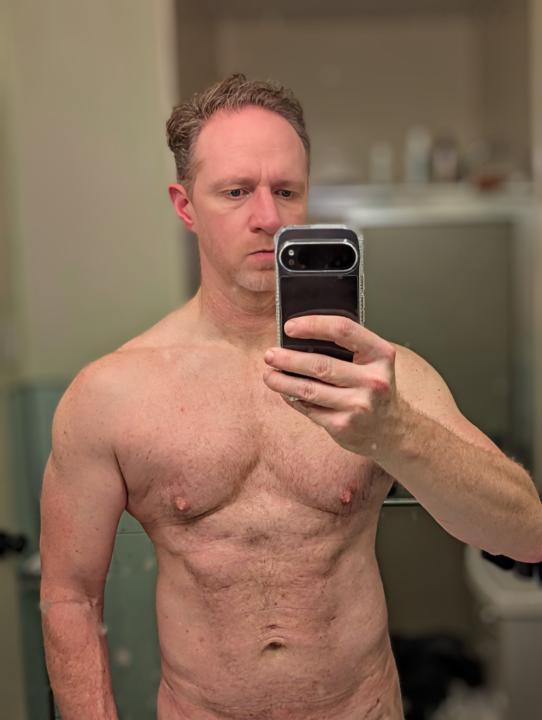 Aaron Madison