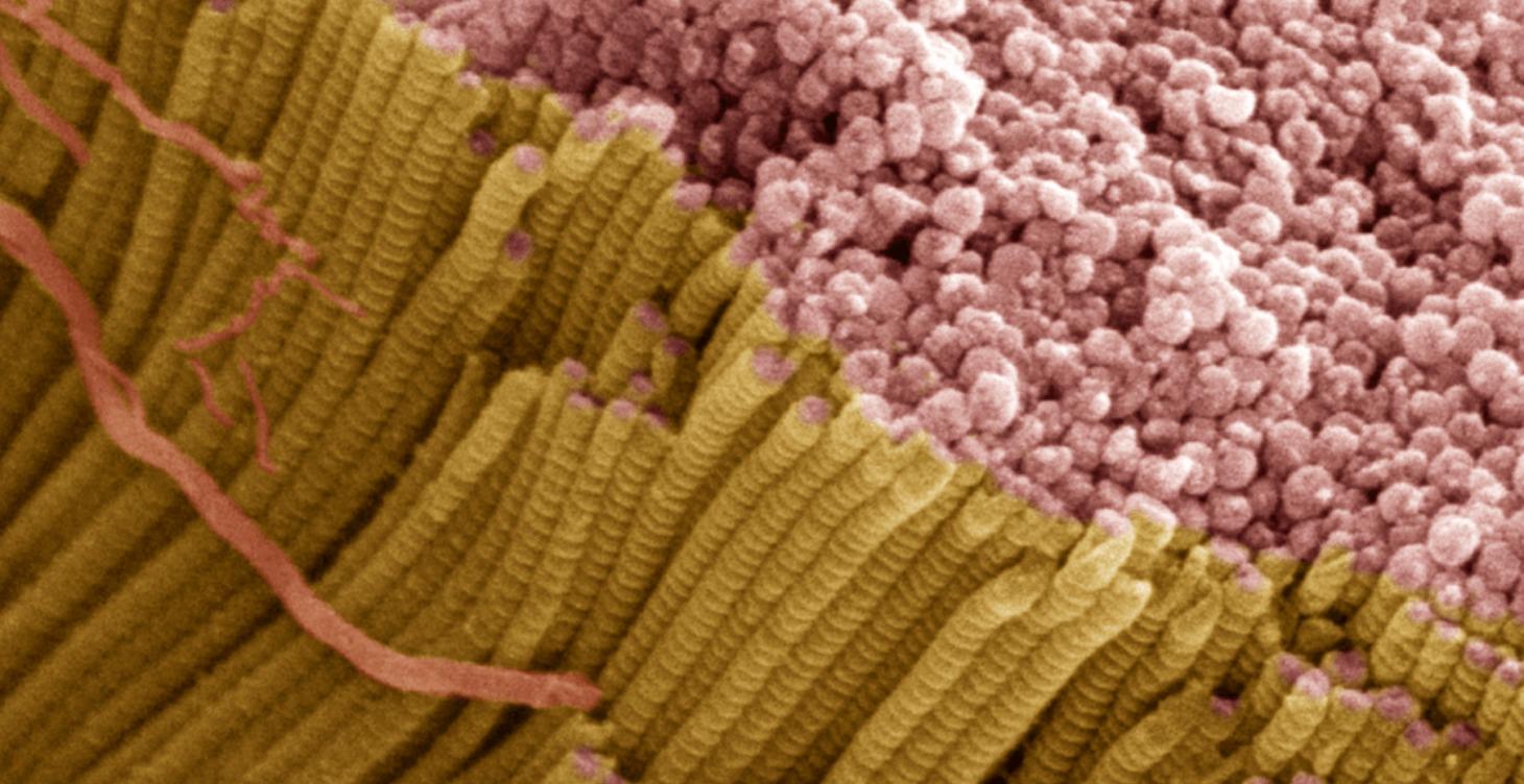 WEBINAR: ¿Cómo se adaptan los tendones?