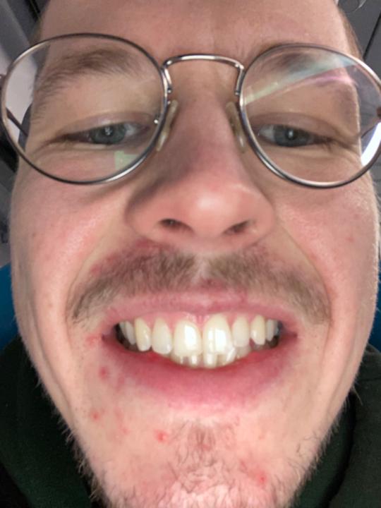 Jonathan Bergsma