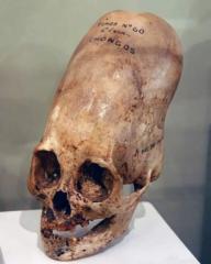 Bonez aka Clare