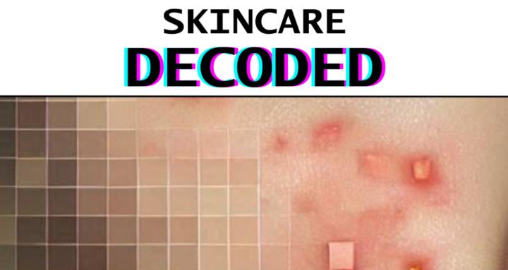 Skin Reset