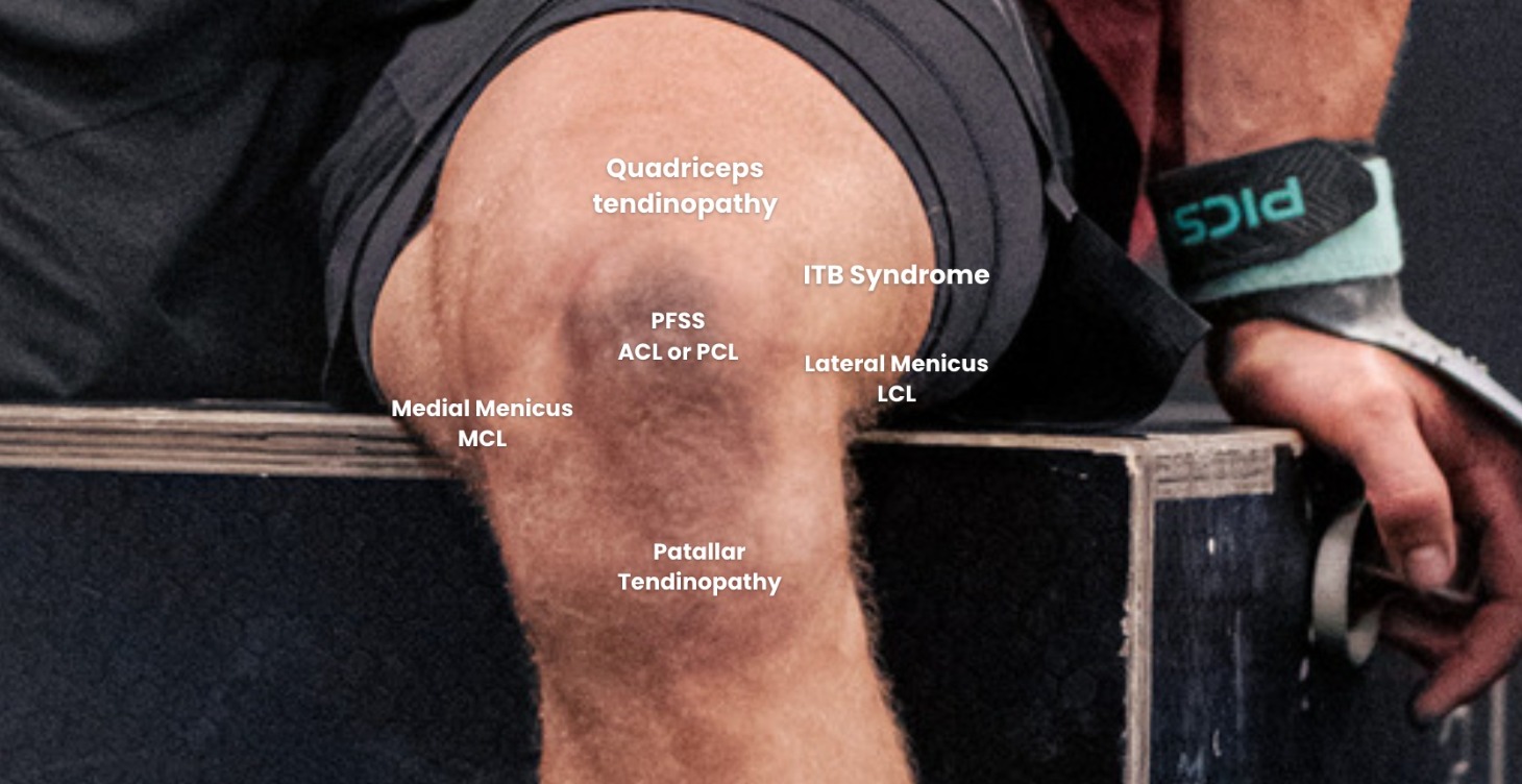 Accelerate Your Knee Tendon