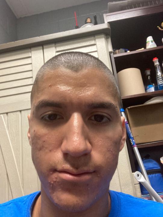 Eric Acuna