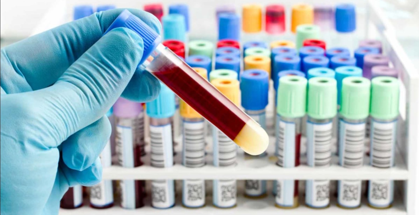 Quarterly Bloodwork Guide