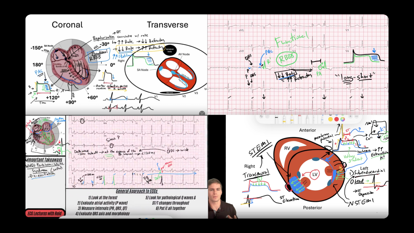 ECG With Reid - Full Course